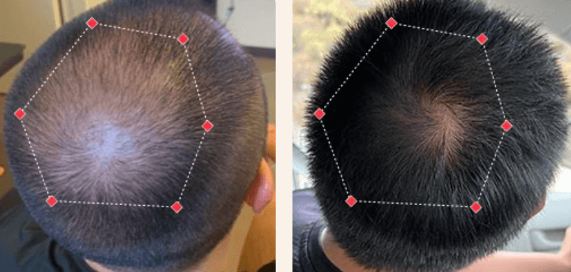 After 3 weeks: thinning crown